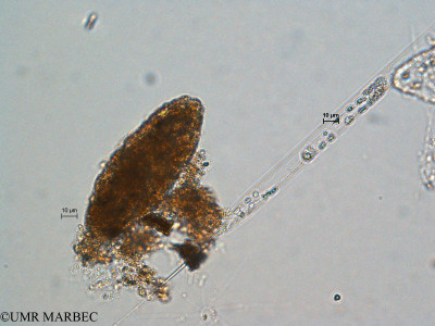 phyto/Scattered_Islands/all/COMMA April 2011/Rhizosolenia setigera f. pungens (ancien R. sp5)(copy)_thumb.jpg